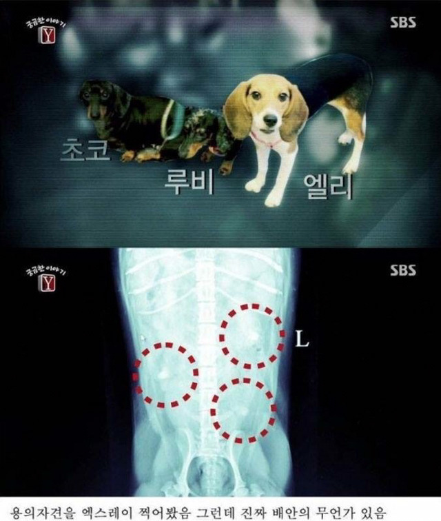 자고 일어나니 발가락이 모두 사라진 남자 | 인스티즈