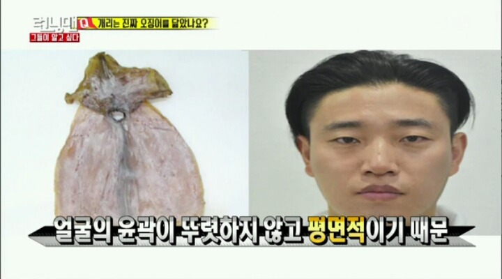 성형외과 의사가 말하는 못생긴 사람을 오징어라 부르는 이유 | 인스티즈
