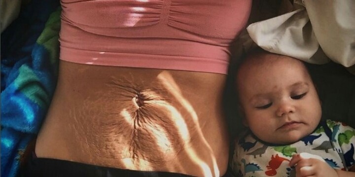 이 사진은 임신과 출산의 어두운 면을 조명했다 | 인스티즈