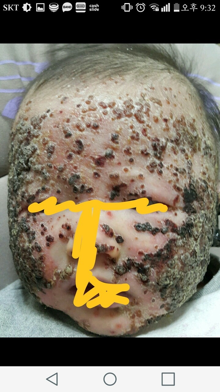 아기 약 안먹이고 자연 치유 시키는 안아키 라는 카페.jpg (혐오주의) | 인스티즈