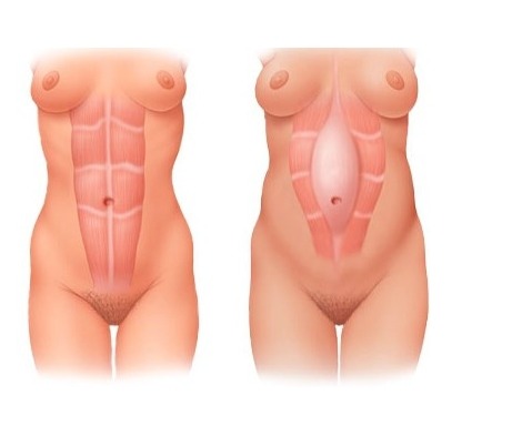 임산부 모두에게 일어나는 증상이지만 대부분의 사람들이 모르는 거 | 인스티즈