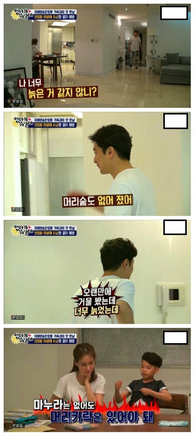 남자에게 머리카락이 중요한 이유 | 인스티즈