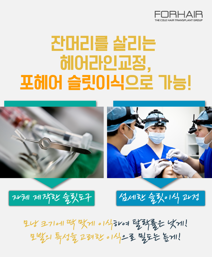 진헤어라인 이미지