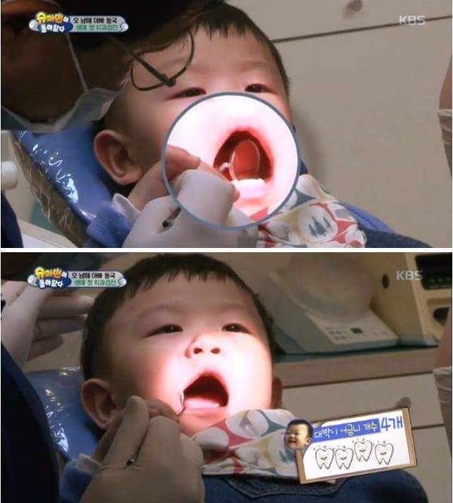 [슈돌] 치과에 간 대박이 | 인스티즈